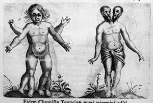 Verschiedene Arten von menschlichen Monstern. Gravur aus „De monstrorum natura, causis et differentiis“ von Fortunio Liceti (1577-1656), italienischer Wissenschaftler. 1646
