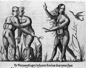 Verschiedene Arten menschlicher Monster: ein Mann mit doppelten Körpern und Köpfen und eine Frau mit vier Beinen und zwei Geschlechtern. Stich aus „De monstrorum natura, causis et differentiis“ von Fortunio Liceti (1577-1656), italienischer Wissenschaftler