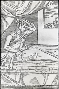 Rhinoplastik-Operation, bei der die Nase des Patienten an eine Hautklappe am Oberarm angeschlossen wurde