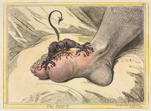 Die Gicht von James Gillray