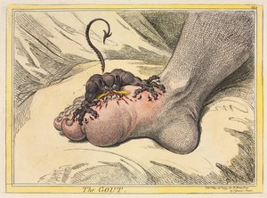 Die Gicht, 1799 von James Gillray