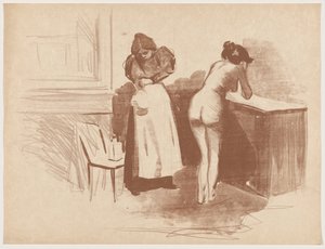 Die Reibung mit dem Haarhandschuh (Massage mit grobem Haarhandschuh)