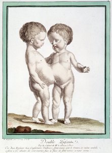 Siamesische Kinder - in „Les deviations de la nature“ von Régnault von Jean Baptiste Regnault
