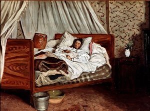 Die improvisierte Ambulanz (Claude Monet verwundet). Gemälde von Jean Frédéric Bazille (1841-1870)