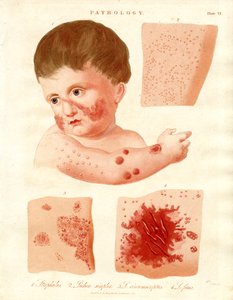 Pathologische Hautkrankheiten von John Pass