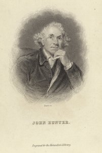 John Hunter von Joshua Reynolds