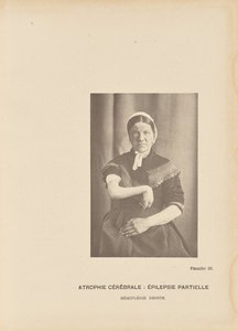 Zerebrale Atrophie: Partielle Epilepsie, rechte Hemiplegie von Paul Marie Léon Regnard