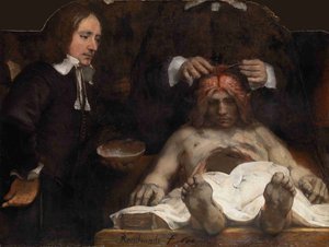 Die Anatomie-Lektion des Dr. Jan Deijman, 1656