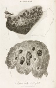 Dermatologie Hautkrankheiten von John Pardon