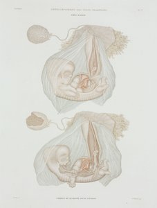 Gynäkologie: Menschlicher Fötus im Alter von 40 Tagen, ca. 1847-1859