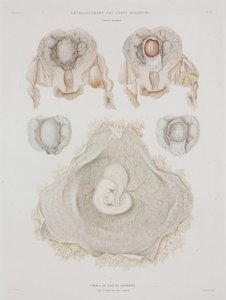 Gynäkologie: Menschliche Gebärmutter mit Embryo, ca. 1847-1859