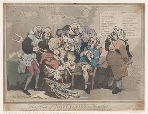 Amputation, 17. Februar 1786