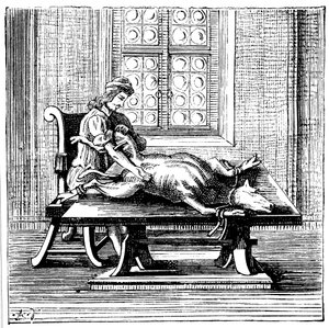 Tier-zu-Mensch-Bluttransfusion, 1679