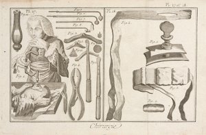 Trepanation von Unbekannt