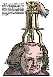 Trepanation