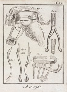 Frühneuzeitliche orthopädische Chirurgie von Unbekannt