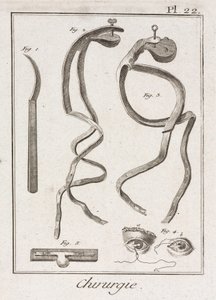 Ausrüstung, frühneuzeitliche Augenchirurgie von Unbekannt