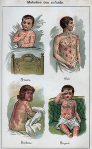 Kinderkrankheiten: Nesselsucht, Masern, Krätze, Scharlach. In „Die neue natürliche Heilung“ von F.E. Bilz.