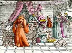 Arzt: „Eine Trepanation“. Ein Chirurg operiert den Schädel seines Patienten. Gravur aus dem 16. Jahrhundert Private Sammlung