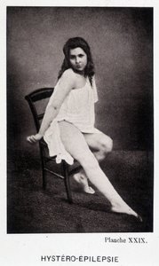 Hystero Epilepsie - Kontraktur in „Photographische Ikonographie der Salpêtrière: Dienst von Herrn Charcot“ von Paul Regnard und Bourneville