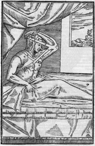 Nasenchirurgie: Rekonstruktive Chirurgie an der Nase in „De curtorum chirurgia per insitionem“. Venedig