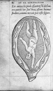 Die Position des Fötus in der Gebärmutter während der Schwangerschaft. Gravur aus „De la generation des enfants“ von Ambroise Paré (1509-1590) 16. Jahrhundert von Unknown artist