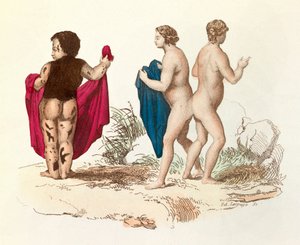 "Gesammelte Werke von Buffon": Naturgeschichte des Menschen: junger Schwarzer mit Hirsutismus und Siamesen (Gravur)