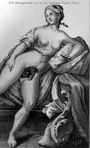 Hermaphroditisches Mädchen, gesehen 1751 und nach der Natur gezeichnet