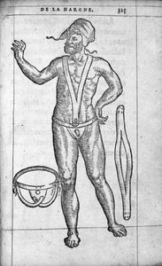 Medizin: ein Bruchband. Gravur aus „De la hargne“ von dem französischen Arzt und Chirurgen Ambroise Paré (1509-1590) 16. Jahrhundert von Unknown artist