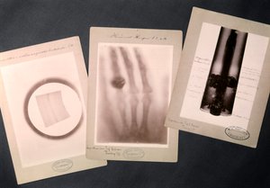 Originale Radiographien von Röntgen von Wilhelm (after) Röntgen