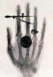 Wilhelm Roentgens Röntgenaufnahme der Hand seiner Frau, 1896 von Wilhelm Conrad Rontgen