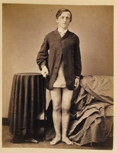 Private G. W. Warrington, Genesung ohne Amputation nach Schussfraktur der rechten Kniescheibe, aus dem fotografischen Katalog der chirurgischen Abteilung von William Bell