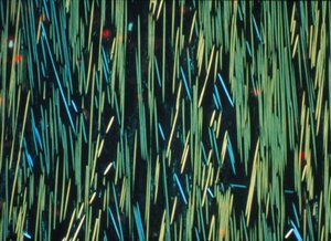 Verbundwerkstoff, LM PMC Kohlefaser in einer Polymermatrix von Frederick (attr. to) Barnard