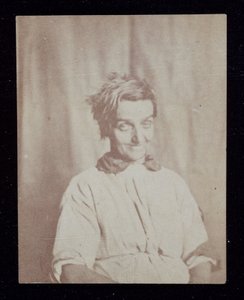 Psychiatrie Porträt eines Patienten, Surrey County Asylum, ca. 1852 von John Pardon