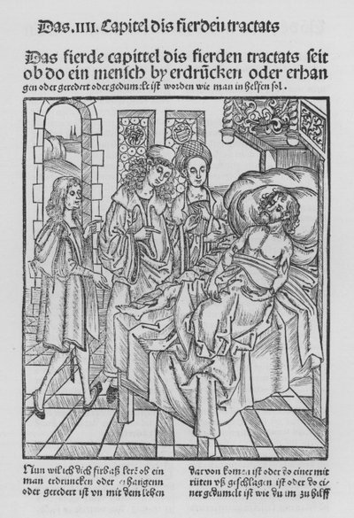 Das Buch der Chirurgie von Hieronymus Brunschwig von (after) German School