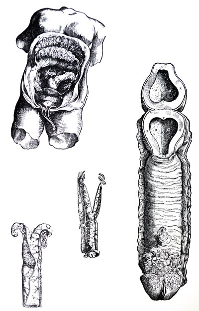 Die Platten aus dem fünften Buch der De Humani Corporis Fabrica von Andreas Vesalius