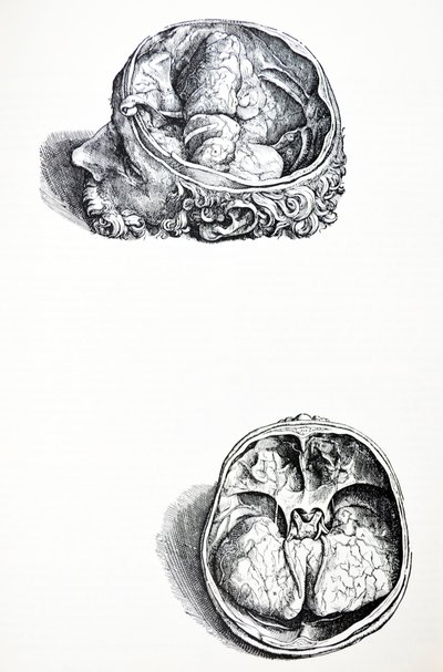 Die Platten aus dem siebten Buch der De Humani Corporis Fabrica von Andreas Vesalius