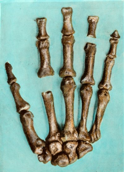 Rechte Hand eines Frauenskeletts von der prähistorischen Stätte Ferrassie in der Dordogne aus dem Mittelpaläolithikum. Gravur von Anonymous Anonymous