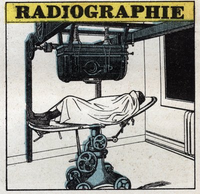 Röntgenstrahlen: Röntgengerät. Anonyme Illustration von 1925. Private Sammlung. von Anonymous Anonymous