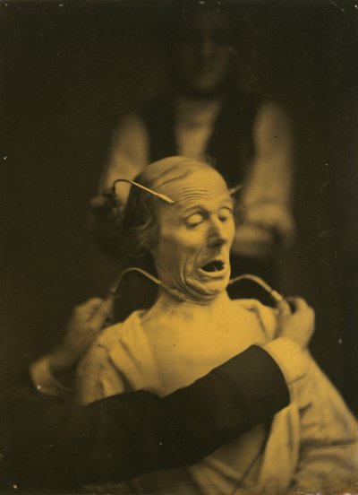 Ausdruck des Terrors, 1854-1856, gedruckt 1862 von Duchenne de Boulogne