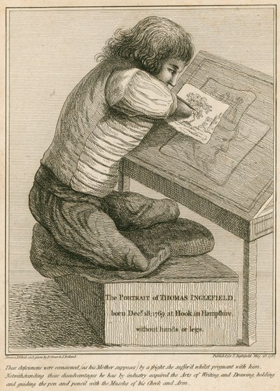 Thomas Inglefield, geboren am 18. Dezember 1769 in Hook, Hampshire, ohne Arme oder Beine von English School