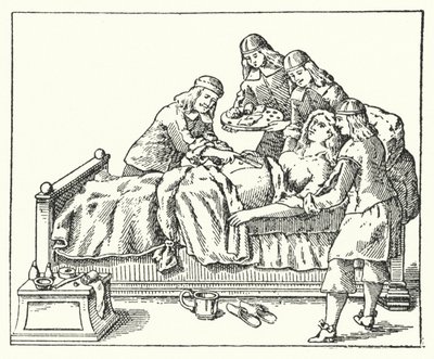 Ein Kaiserschnitt im 17. Jahrhundert von European School