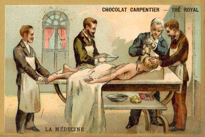 Trepanation von French School