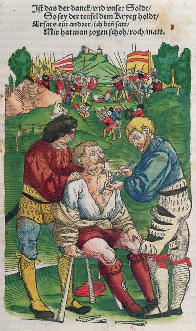 Entfernung eines Pfeils, Illustration aus Feldtbuch der Wundartzney von Hans von Gersdorff, 1540 von German School