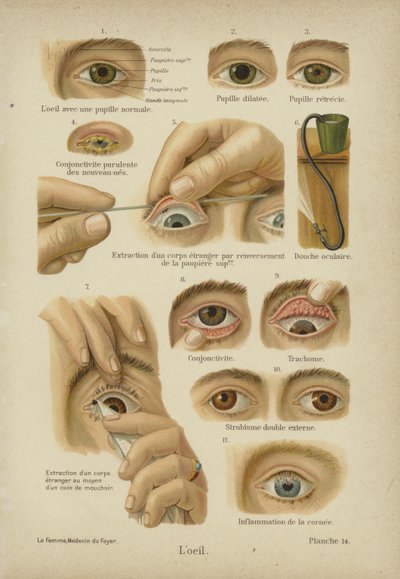 Das Auge von German School
