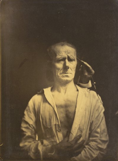 Krampf des M. corrugator supercilii unter sehr starkem Licht (links); Ein entspanntes Gesicht (fotografiert im vollen Sonnenlicht) (rechts) von Guillaume Benjamin Amant Duchenne
