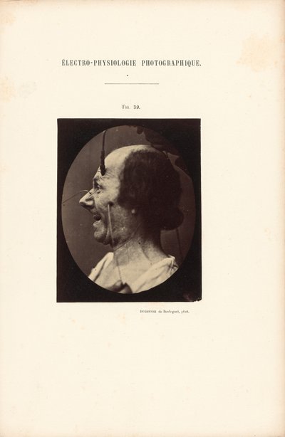 Électro-Physiologie Photographique, Abbildung 39 von Guillaume Benjamin Duchenne