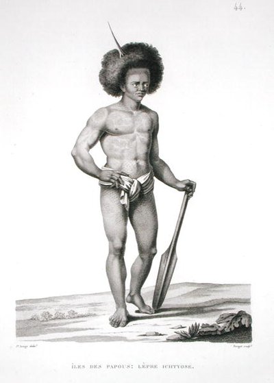 Papua-Inseln: Leprakranker, aus 
