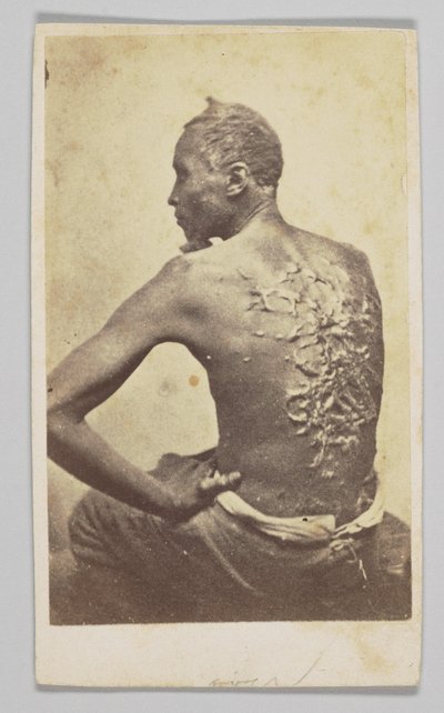 Gordon bei der medizinischen Untersuchung, 1863 von McPherson and Oliver