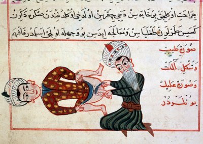 Medizin: Kastration eines Hermaphroditen. Miniatur aus einem türkischen Medizintraktat von Sharaf al-din von Ottoman School